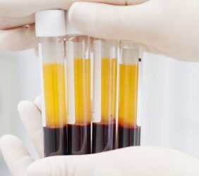 prp