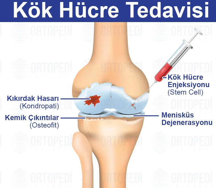 kok hucre tedavis